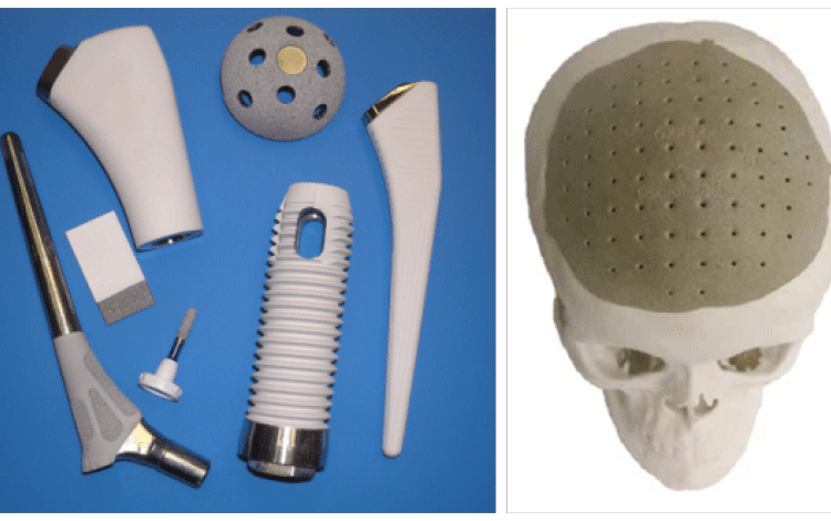 Ejemplos de los implantes de polímeros. Cortesía: Laura Barillas.