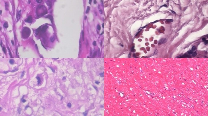 Imágenes de células con formas varias.