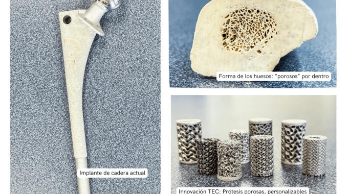 La imagen muestra una prótesis de cadera actual. Un hueso, con su forma porosa y los nuevos implantes porosos del TEC