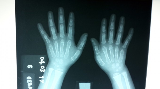 Imagen de rayos X.
