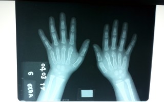 Imagen de rayos X.