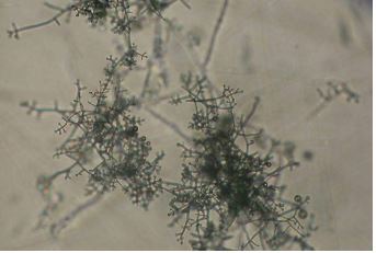 Aislamiento, uso y evaluación de cepas de Trichoderma sp en laboratorio y campo, para el control biológico del hongo Sclerotium cepivorum Berkeley, causante de la pudrición blanca de bulbos de cebolla