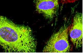 Determinación de la tasa de regeneración en heridas cutáneas aplicando células madre mesenquimales derivadas de tejido adiposo en un andamio de origen biológico.