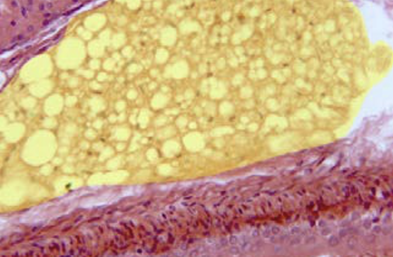 Aislamiento, caracterización e identificación de células madre mesenquimales provenientes de tejido adiposo, para su incorporación en apósitos biológicos y aplicación en ingeniería de tejidos