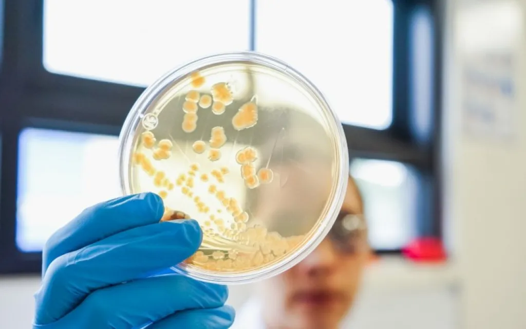 Fotografía de cultivo de laboratorio