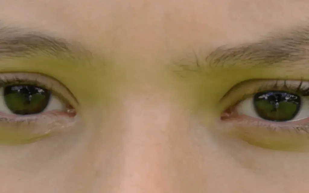 Ojos