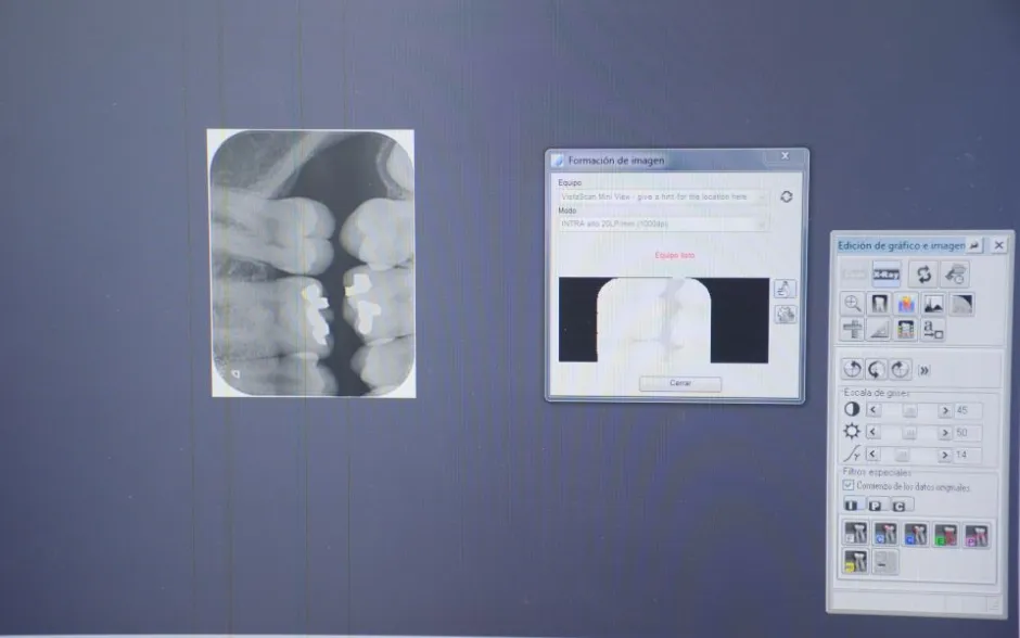 Detalle de los rayos X tomados al estudiante