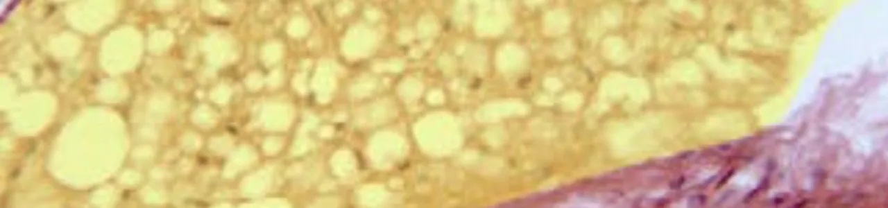 Aislamiento, caracterización e identificación de células madre mesenquimales provenientes de tejido adiposo, para su incorporación en apósitos biológicos y aplicación en ingeniería de tejidos