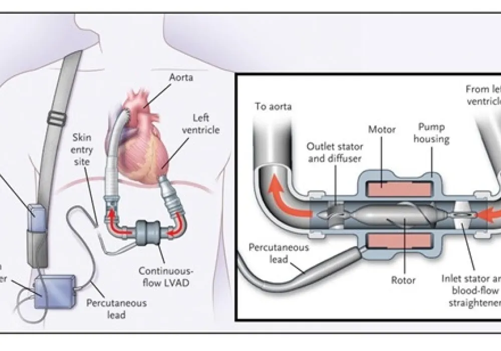 Representación corazón