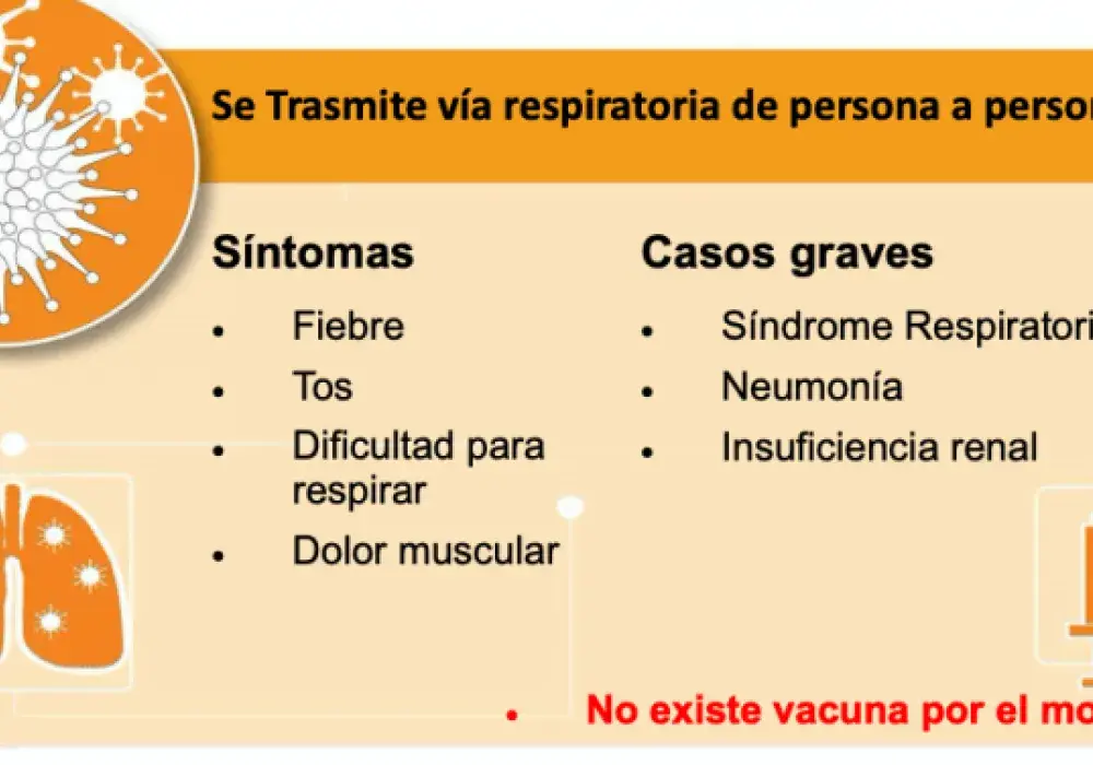 Infografía