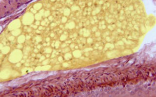 Aislamiento, caracterización e identificación de células madre mesenquimales provenientes de tejido adiposo, para su incorporación en apósitos biológicos y aplicación en ingeniería de tejidos